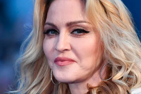 Madonna: tras sufrir una fuerte infección, pospone su gira mundial El representante de Madonna compartió información sobre su estado de salud.