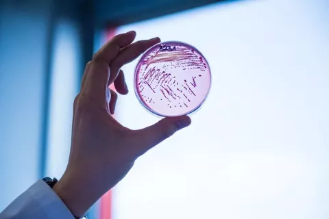 Legionella: lo que tenés que saber sobre este brote Legionella, una bacteria que generó un brote de neumonía bilateral.