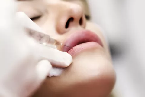 ¿Podés aplicarte bótox si estás embarazada? Bótox: ¿se recomienda en embarazadas?