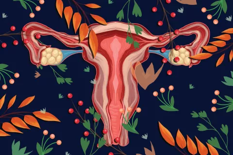 Cuello uterino: del HPV a los pólipos, estas son las 5 enfermedades más comunes Cuáles son las enfermedades más comunes del cuello uterino.