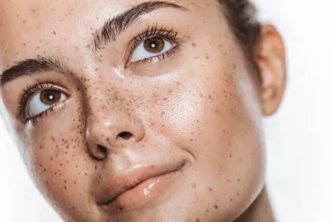 Tatuarse: cuál es la técnica para hacerse pecas semipermanentes Pecas tatuadas: una tendencia.