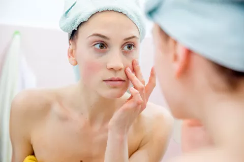 Ojeras: tratamientos caseros que te pueden ayudar a mejorarlas Cuáles son los mejores tratamientos caseros para las ojeras.