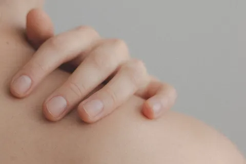 Lo que la psoriasis me enseñó: cómo es vivir con esta enfermedad La psoriasis es una enfermedad autoinmune de la piel que afecta a muchos argentinos.