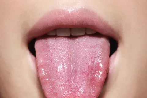 La lengua: funciones que no conocías de este órgano poderoso y sensible G3XPF5QRMFH73PNZWNNQW363CM.jpg
