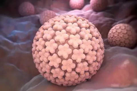 Lo que necesitás saber sobre el HPV: cómo prevenirlo El HPV es responsable de más del 95% de casos de carcinoma de cérvix
