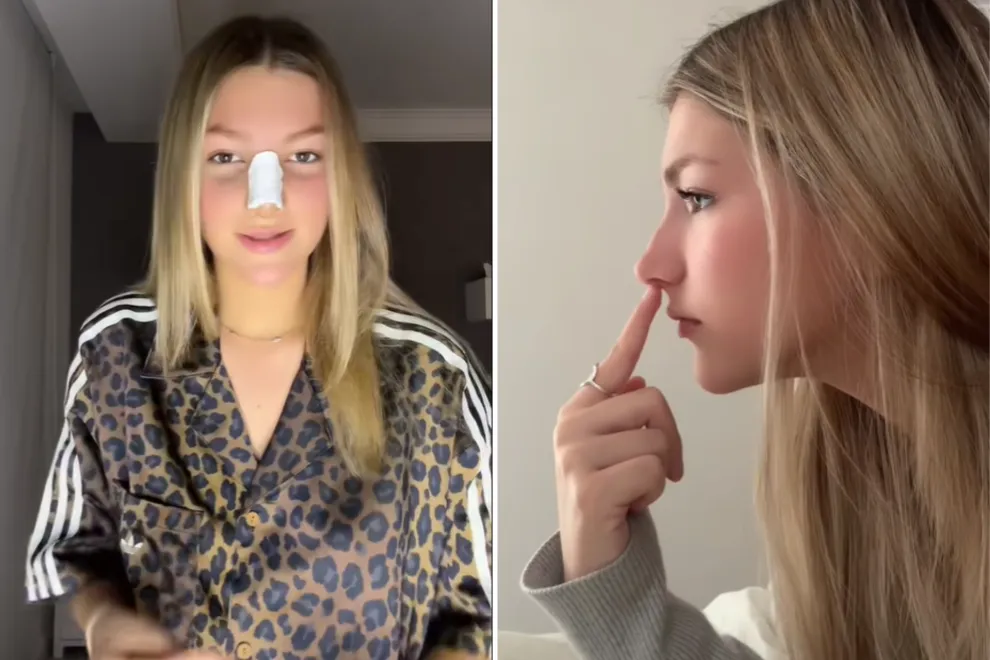 Jazmín Oltra se operó la nariz a los 16 años y dijo que se sacó un trauma