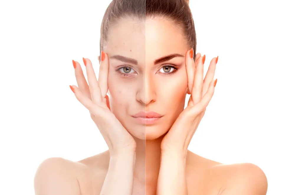 Glow puro: cómo lograr luminosidad natural en la piel.